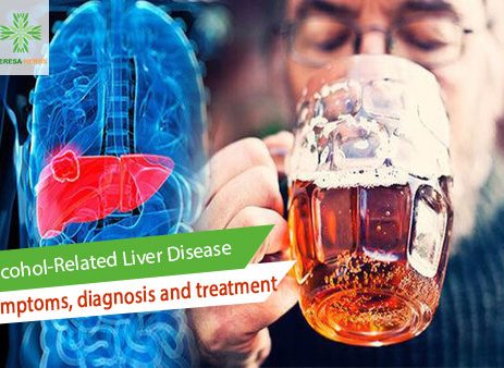 alcohol related liver disease