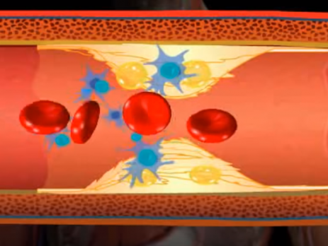 how to cholesterol affect the body